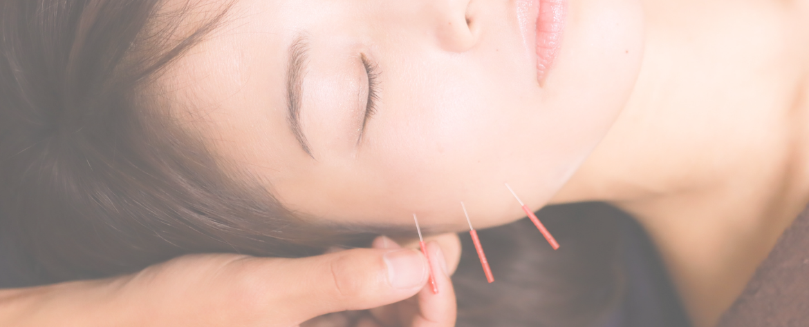 acupuncture