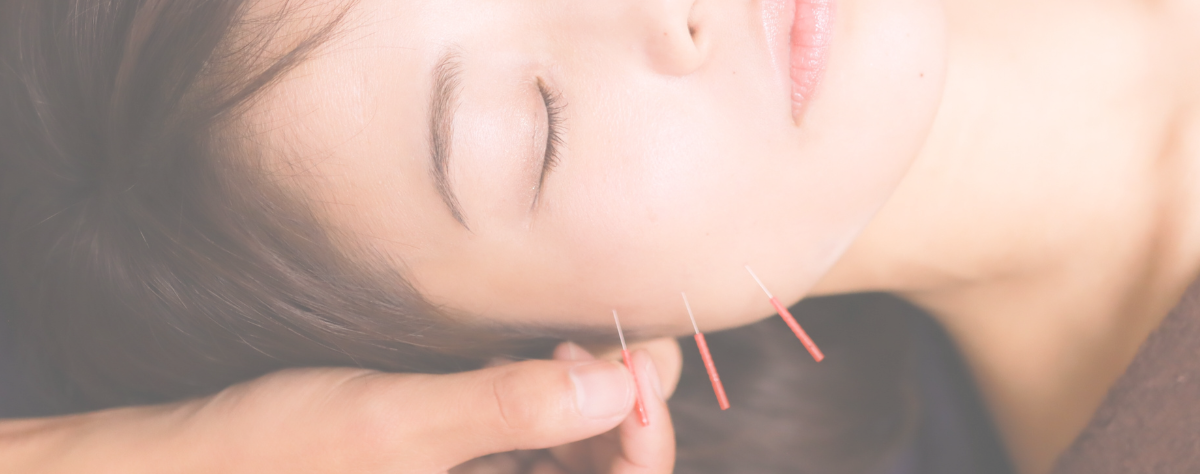 acupuncture