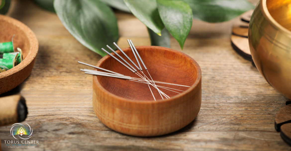 acupuncture-blog-benefits